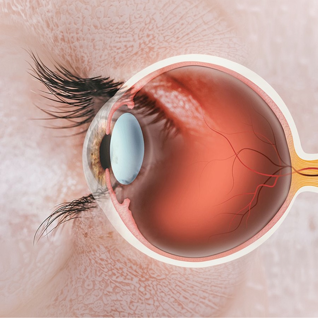 Retina e fundo de olho
